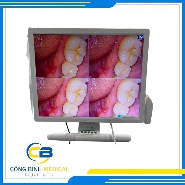 CAMERA SOI RĂNG DYM